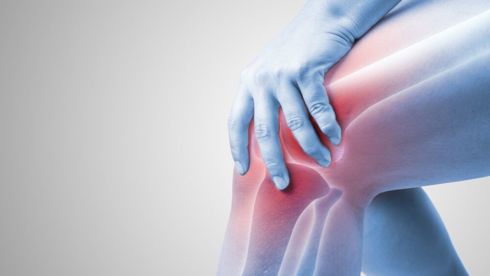 Stan zapalny kolana: poznaj ważne informacje