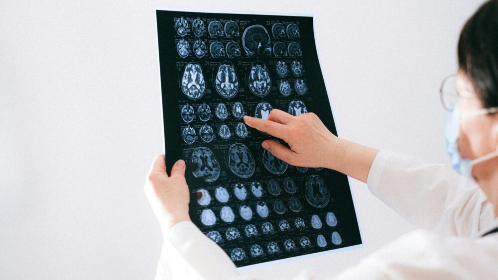 Jak wygląda podstawowe badanie neurologiczne?