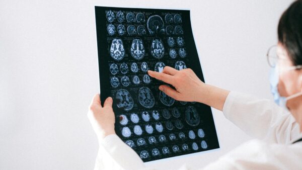 Jak wygląda podstawowe badanie neurologiczne?